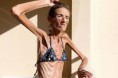 /album/fotogaleria/anorexia3-jpeg/